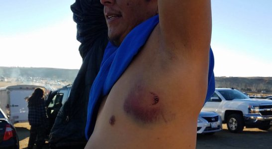 Photo supplied by Indigenous Environmental Network